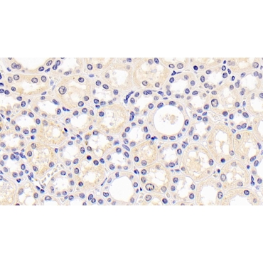 Kidney Injury Molecule 1 (Kim1) Human Monoclonal Antibody