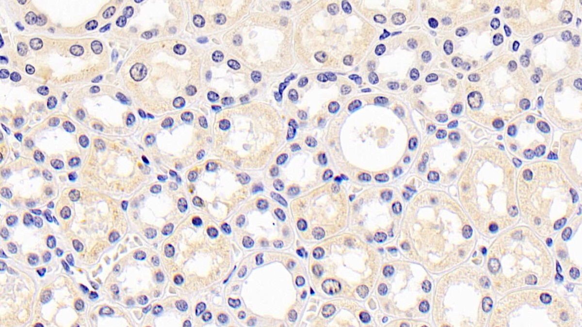 Kidney Injury Molecule 1 (Kim1) Human Monoclonal Antibody