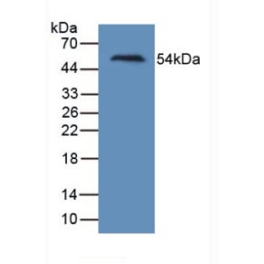 Kidney Injury Molecule 1 (Kim1) Human Monoclonal Antibody
