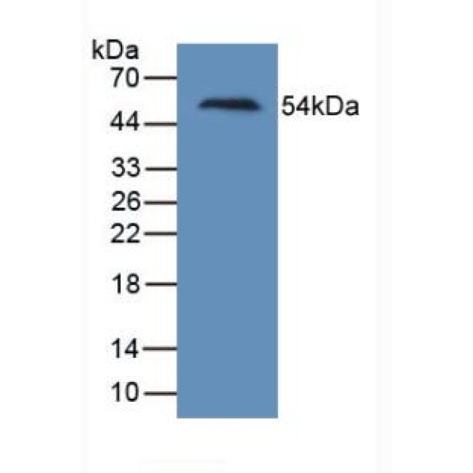Kidney Injury Molecule 1 (Kim1) Human Monoclonal Antibody