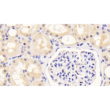Kidney Injury Molecule 1 (Kim1) Human Monoclonal Antibody
