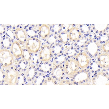 Kidney Injury Molecule 1 (Kim1) Human Monoclonal Antibody