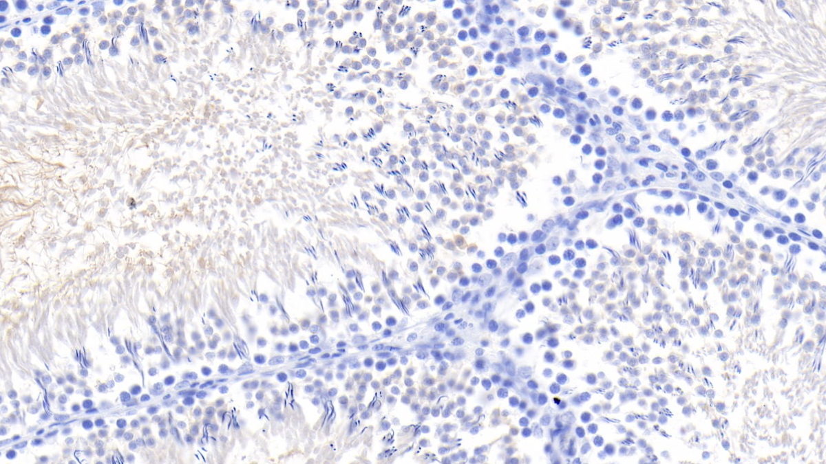 Kidney Injury Molecule 1 (Kim1) Rat Monoclonal Antibody