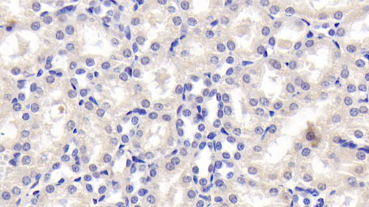 Angiotensinogen (AGT) Rat Monoclonal Antibody
