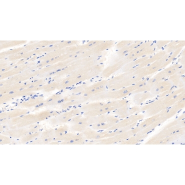 Hypoxia Inducible Factor 1 Alpha (HIF1a) Human Monoclonal Antibody