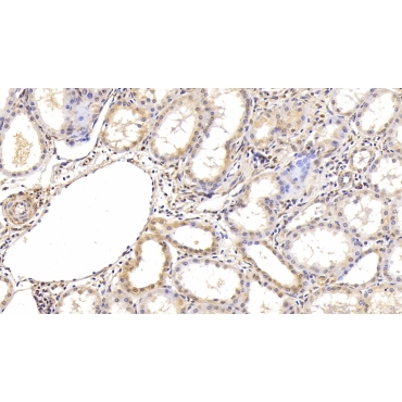 Hypoxia Inducible Factor 1 Alpha (HIF1a) Human Monoclonal Antibody