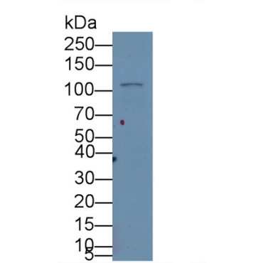 Hypoxia Inducible Factor 1 Alpha (HIF1a) Human Monoclonal Antibody