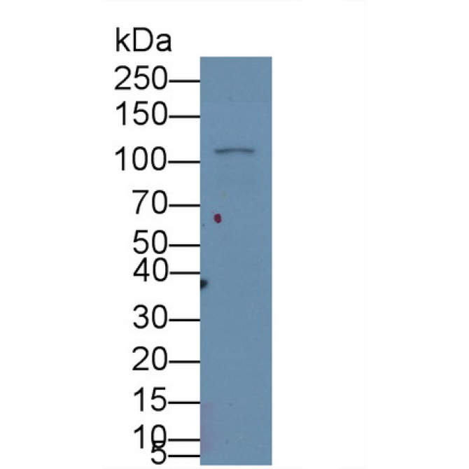 Hypoxia Inducible Factor 1 Alpha (HIF1a) Human Monoclonal Antibody