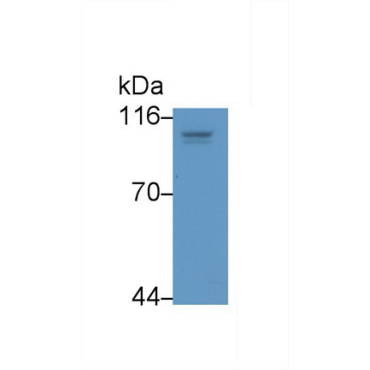 Hypoxia Inducible Factor 1 Alpha (HIF1a) Human Monoclonal Antibody