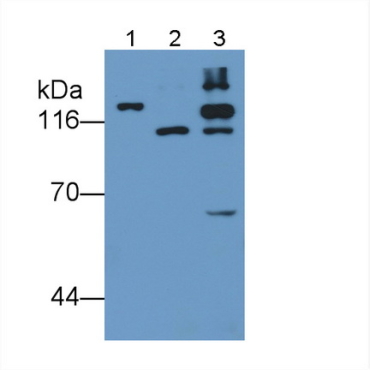 Hypoxia Inducible Factor 1 Alpha (HIF1a) Human Monoclonal Antibody