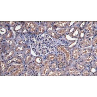 Bone Morphogenetic Protein 7 (BMP7) Human Monoclonal Antibody
