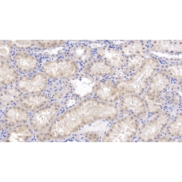 Bone Morphogenetic Protein 7 (BMP7) Human Monoclonal Antibody