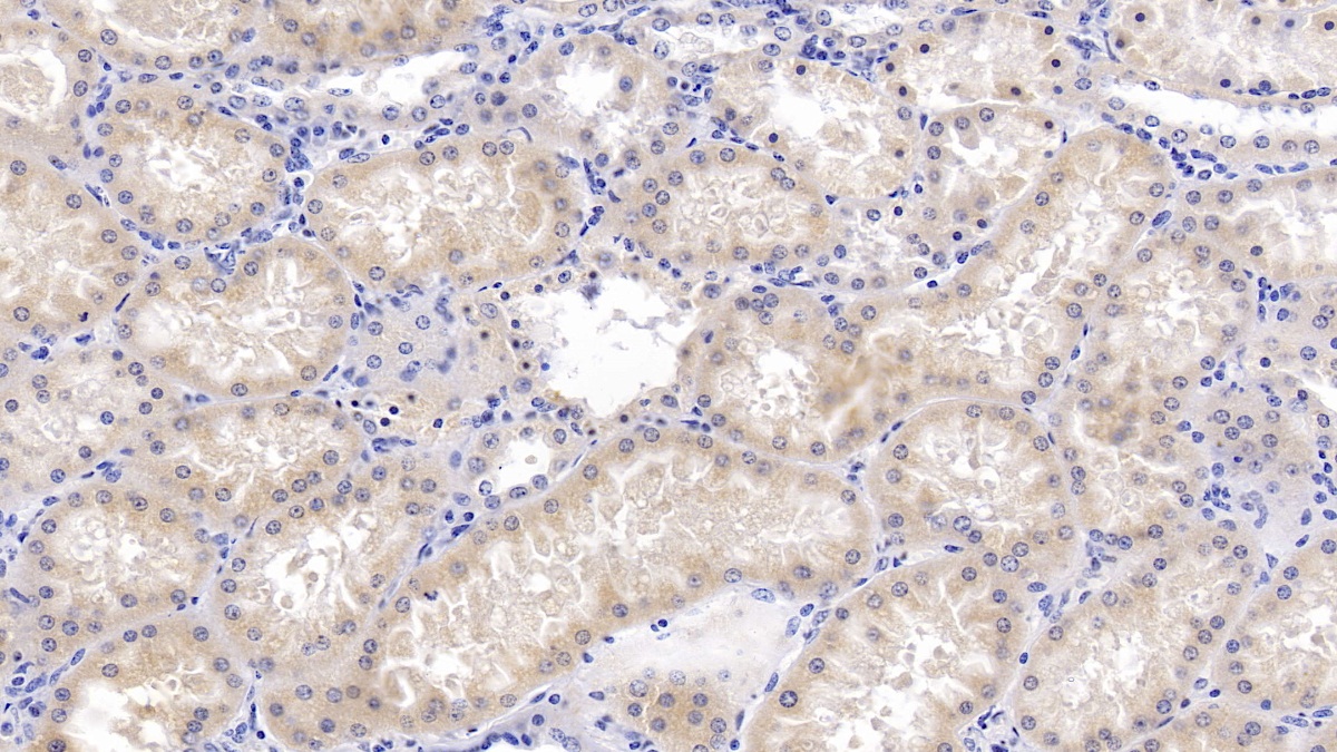 Bone Morphogenetic Protein 7 (BMP7) Human Monoclonal Antibody
