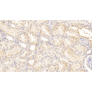 Bone Morphogenetic Protein 7 (BMP7) Human Monoclonal Antibody
