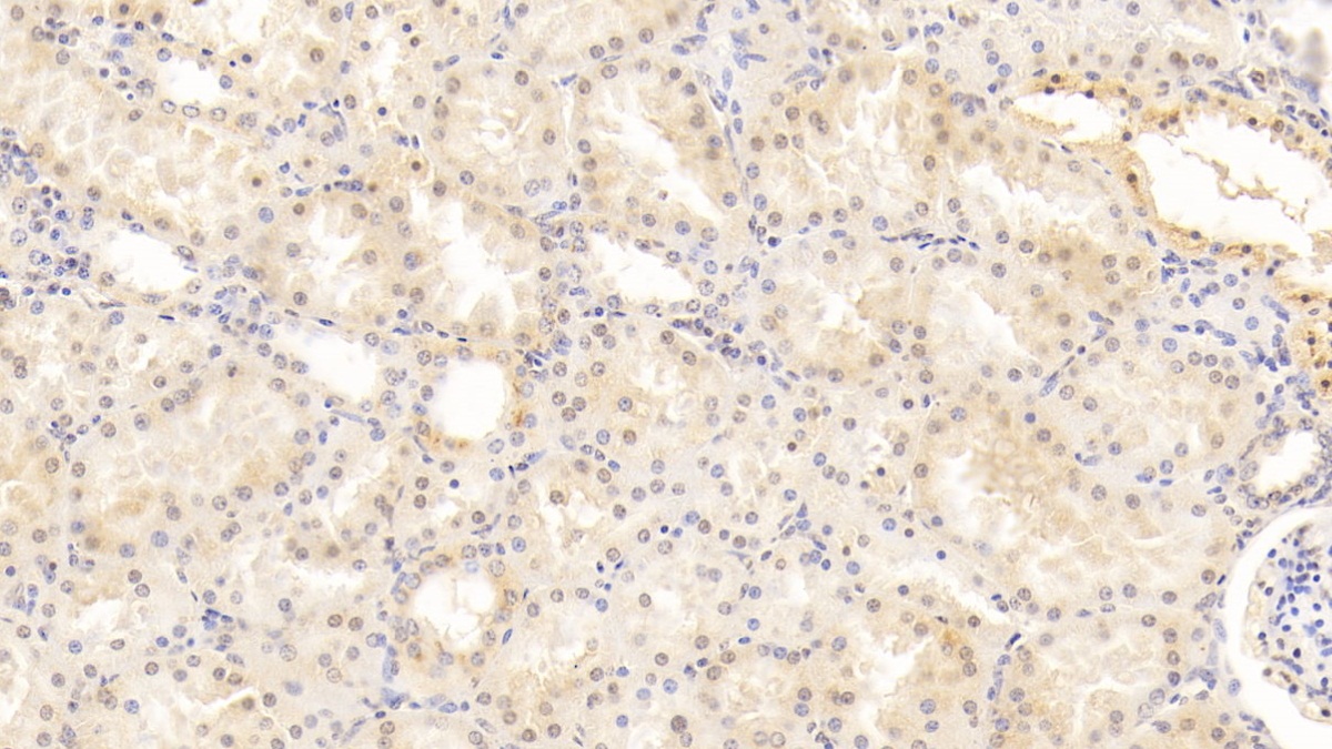 Bone Morphogenetic Protein 7 (BMP7) Human Monoclonal Antibody