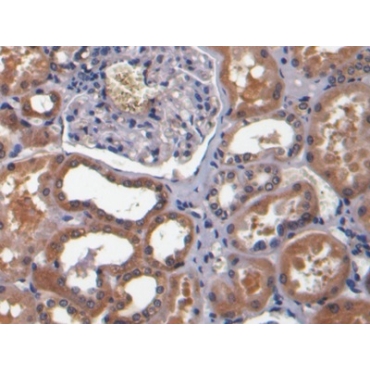 Bone Morphogenetic Protein 7 (BMP7) Human Monoclonal Antibody