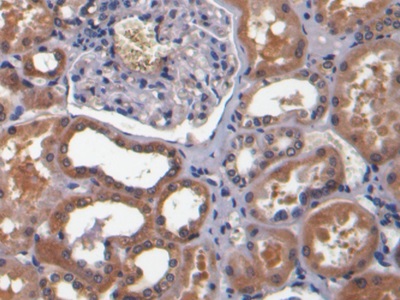 Bone Morphogenetic Protein 7 (BMP7) Human Monoclonal Antibody