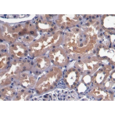 Bone Morphogenetic Protein 7 (BMP7) Human Monoclonal Antibody