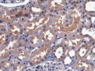 Bone Morphogenetic Protein 7 (BMP7) Human Monoclonal Antibody