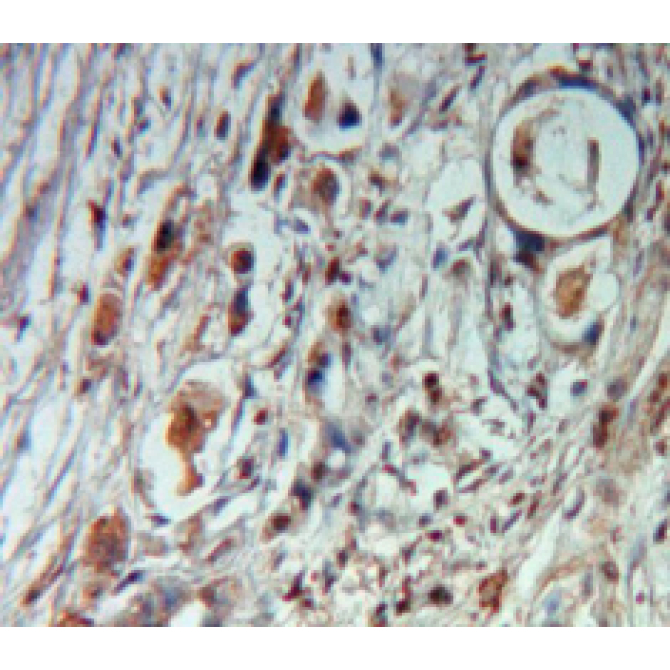 Cholecystokinin (CCK) Human Monoclonal Antibody