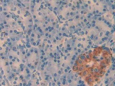 Amylin Pan-species (General) Monoclonal Antibody