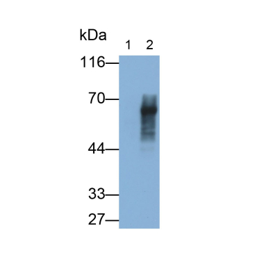 Amylin Human Monoclonal Antibody