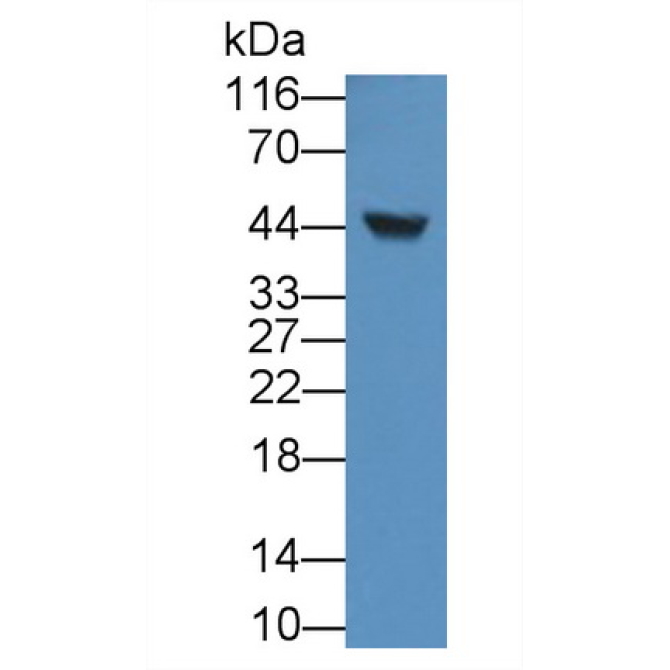 Alpha-1-Acid Glycoprotein (a1AGP) Human Monoclonal Antibody
