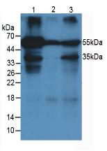 Alpha-1-Acid Glycoprotein (a1AGP) Rat Monoclonal Antibody