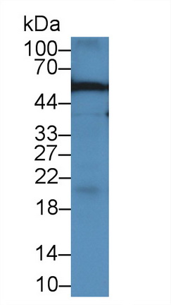 Alpha-1-Acid Glycoprotein (a1AGP) Rat Monoclonal Antibody