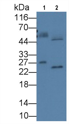 Alpha-1-Acid Glycoprotein (a1AGP) Rat Monoclonal Antibody