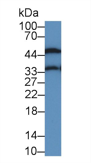 Alpha-1-Acid Glycoprotein (a1AGP) Rat Monoclonal Antibody