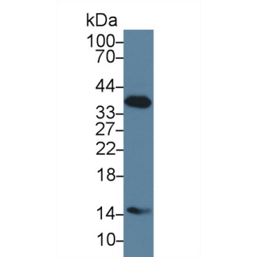 Haptoglobin (Hpt) Human Monoclonal Antibody