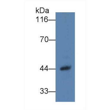 Haptoglobin (Hpt) Human Monoclonal Antibody