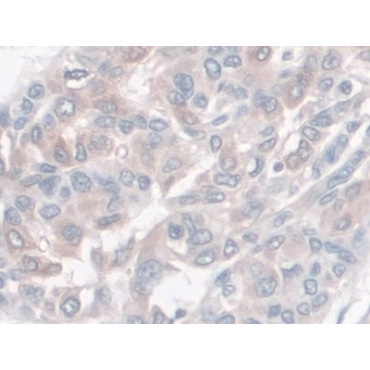 Haptoglobin (Hpt) Human Monoclonal Antibody
