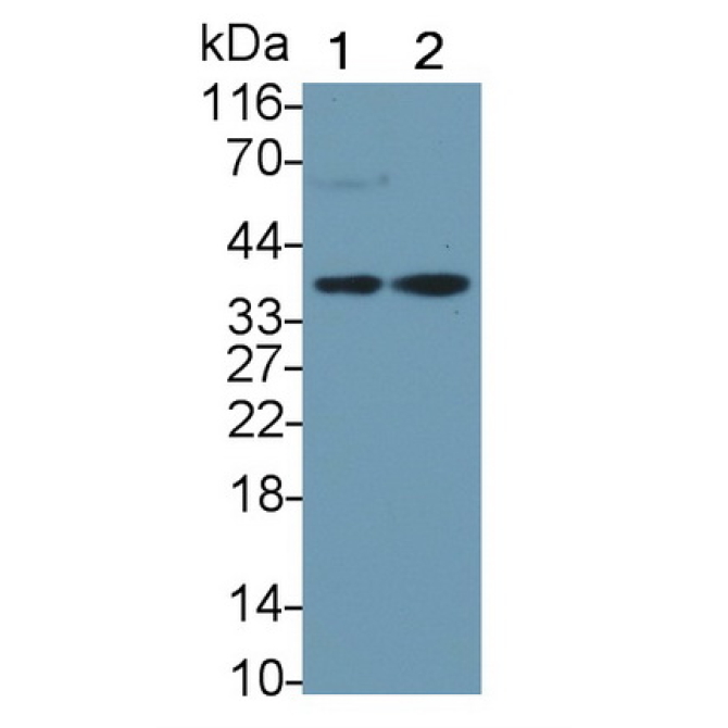 Haptoglobin (Hpt) Human Monoclonal Antibody