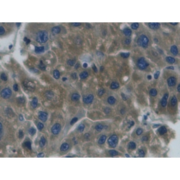 Haptoglobin (Hpt) Human Monoclonal Antibody