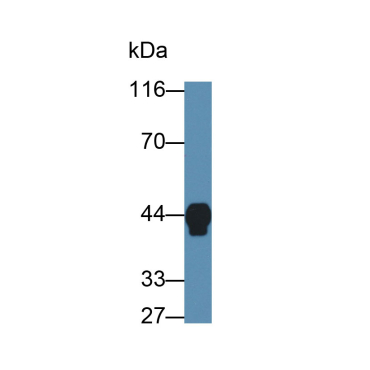 Haptoglobin (Hpt) Human Monoclonal Antibody
