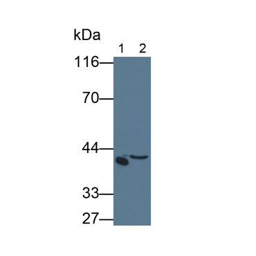 Haptoglobin (Hpt) Human Monoclonal Antibody