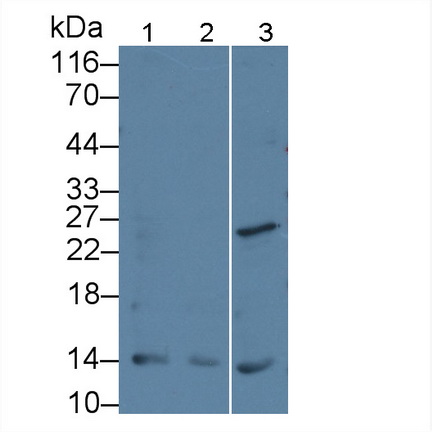 Parathyroid Hormone Related Protein (PTHrP) Rat Monoclonal Antibody