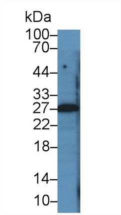 Parathyroid Hormone Related Protein (PTHrP) Rat Monoclonal Antibody