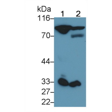 Coagulation Factor II (F2) Human Monoclonal Antibody