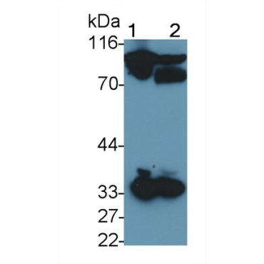 Coagulation Factor II (F2) Human Monoclonal Antibody