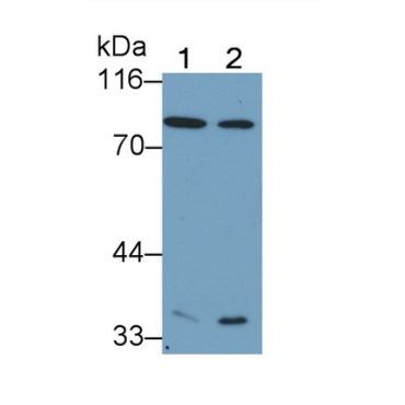 Coagulation Factor II (F2) Human Monoclonal Antibody