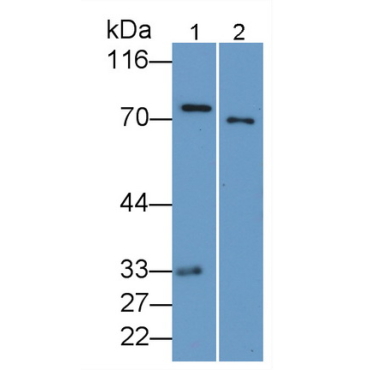 Coagulation Factor II (F2) Human Monoclonal Antibody