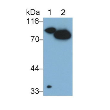 Coagulation Factor II (F2) Human Monoclonal Antibody