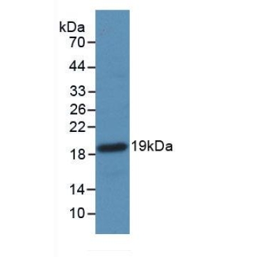 Coagulation Factor II (F2) Mouse Monoclonal Antibody