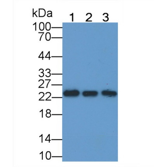 C Reactive Protein (CRP) Human Monoclonal Antibody