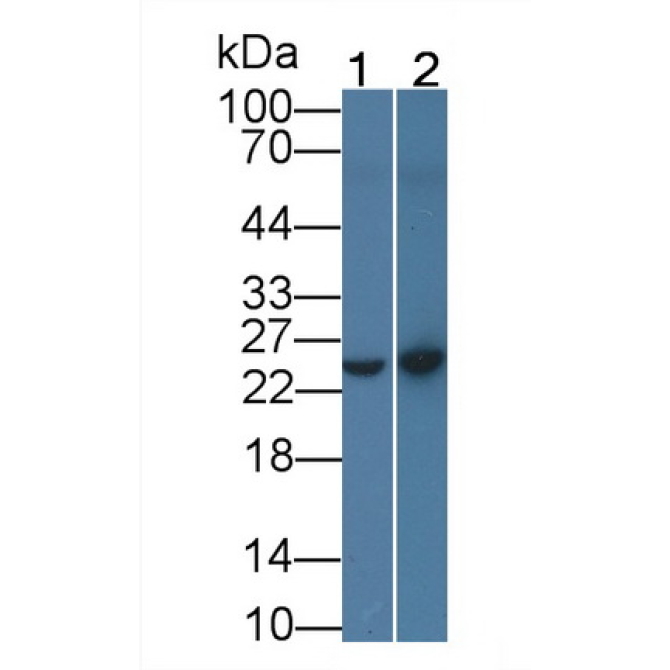 C Reactive Protein (CRP) Human Monoclonal Antibody