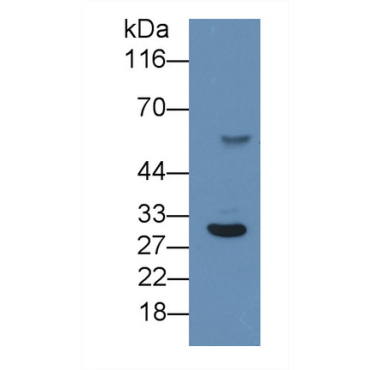 C Reactive Protein (CRP) Human Monoclonal Antibody