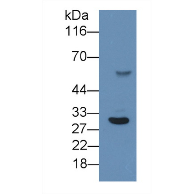 C Reactive Protein (CRP) Human Monoclonal Antibody
